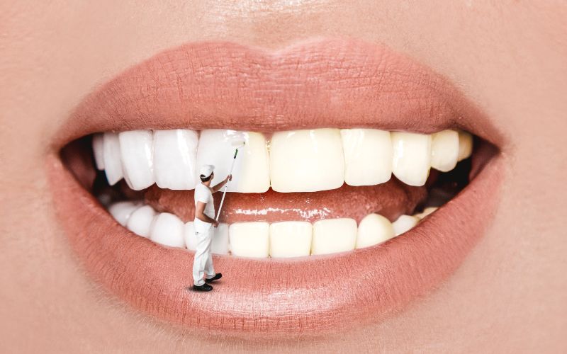 large mouth with a window washing man applied white paint to the teeth